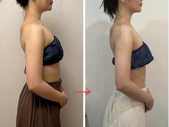 ビノワ(Binowa)/二の腕スッキリ！！