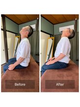 ミントのかべの整体院/一宮/江南/整体/骨盤矯正/肩こり