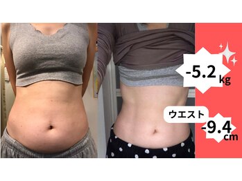 陽なた整体院城陽長池/ウエストがスッキリ！気持ちいい