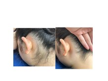 ソラ(SORA)の雰囲気（ダブル脱毛も可能です☆）