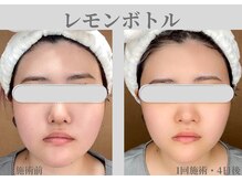 ルーチェ カリーノ(Luce Carino)の雰囲気（今話題のレモンボトル導入しました）