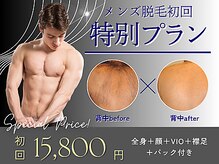 エステルーム コンフォートの雰囲気（男性も通いやすいメンズ脱毛☆【脱毛/ハーブピーリング/松戸駅】）
