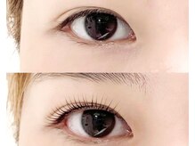 abp /ラッシュリフト