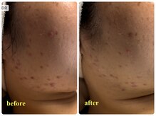 ベルドア(Bell Door)/肌改善