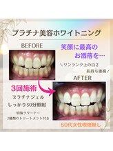 ホワイトニングプラス(Whitening+)/初回はお安く！！