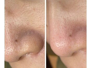 サイ(Sai)/before⇒after