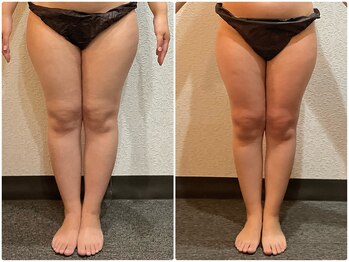 美容整体 ウェリナ 蟹江院/小顔矯正/骨盤矯正/美脚サロン