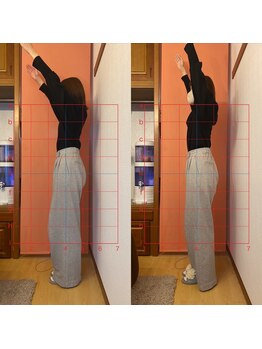 ヴィアス(Vias)/肩こり解消