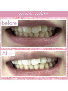 エクシアホワイト 長野店/