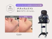 The水光美肌専科の雰囲気（小顔チタニウム！最新機械を使用）