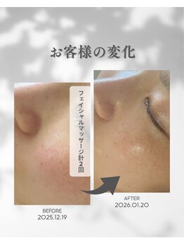 ココフルール(Cocofleur)/お手入れ1回