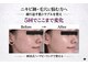 ワイズデュー(Y's Dew)の写真/毛穴黒ずみ・角栓・いちご鼻を押し出さず整える韓国式ハーブピーリングでつるんとなめらかな肌印象へ導く