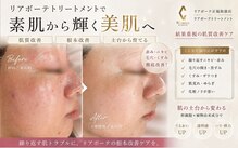 サロンベイア(salon Beia)
