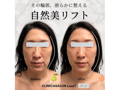 リュクシー(LuxeY)の写真