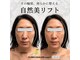 リュクシー(LuxeY)の写真