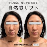 リュクシー(LuxeY)