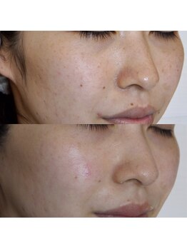 トラット エステアンドアイズ(tratto)/30代　お客様症例写真