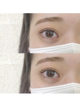 フランセス(Frances)/上下ラッシュリフト