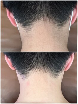 バーニー 梅田店(BARNEY)/施術イメージ４【メンズ】