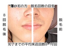 イチキュービー 仙台駅前東口店(19B)の雰囲気（【薄いひげ】平均回数：8～12回　実績店だから少ない回数で完了!）