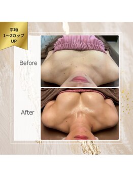 ロココ 町田店(Rococo)/バストの位置上げてボリュームUP