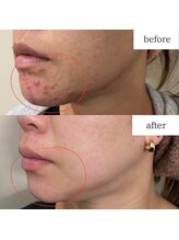 アルルプラス 山科(ARuru+)/beforeafter