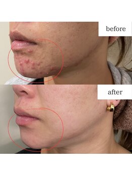 アルルプラス 山科(ARuru+)/beforeafter