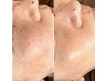 イロドリ(irodori)/万能！！ジュエリーピール♪