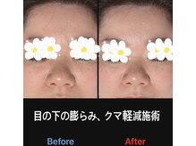 美容矯正サロン レレポノ(LELEPONO)/