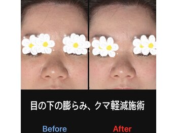 美容矯正サロン レレポノ(LELEPONO)/