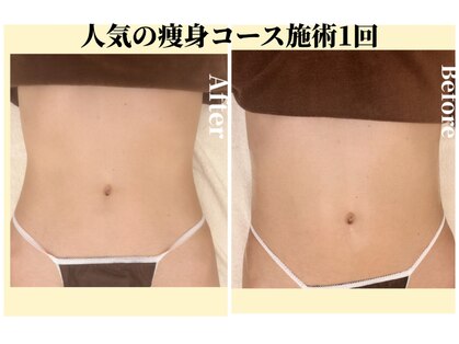 プレジール エテ(plaisir Ete)の写真