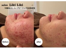 リラクゼーションネイルサロンリキリキ(Relaxation Liki Liki)