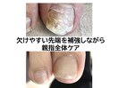 足爪ベーシック+亀裂補修Option