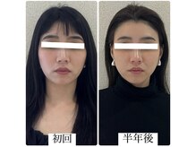 ラボーテヴェリテ(La Beaute Verite)/【お客様施術例】