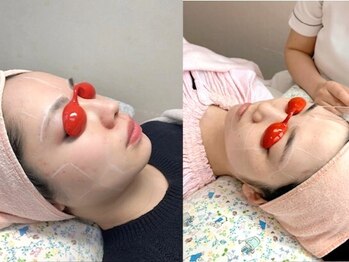 和歌山ビューティー アガ(AGA)の写真/自信をもっておすすめ！とことん丁寧！ベテランスタッフだからできる細やかな顔脱毛。初回価格あります。