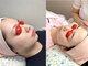 和歌山ビューティー アガ(AGA)の写真/自信をもっておすすめ！とことん丁寧！ベテランスタッフだからできる細やかな顔脱毛。初回価格あります。