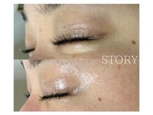 ストーリー 沼津店(STORY)/ハーブピーリング専門店STORY