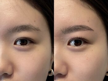 ユニ(uni)/Before / After