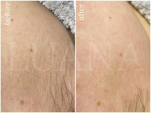 ルアナ(LUANA)/フェイシャルWAX