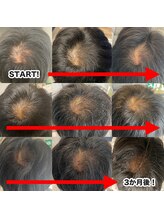 ショートルーム(shortroom)/育毛促進で頭皮環境改善！