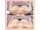 リソラ(risora)の写真