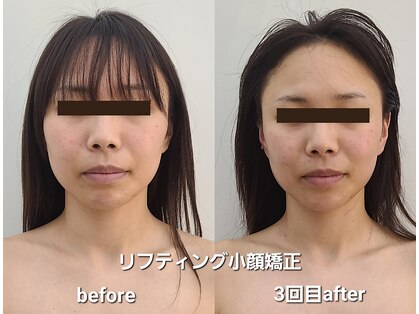 アールフェイスバランスの写真