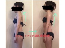 ビューティー サロン ハナ(Beauty Salon hana)の雰囲気（1回施術効果☆姿勢が整う事で頭痛から解放されました^ ^）