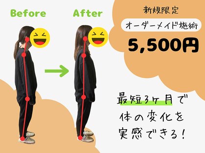アロゼの写真