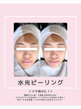 ソワナ(soina)/【神楽坂駅/フェイシャル/毛穴】