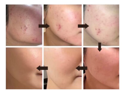 アイル 船橋店(iru)の写真