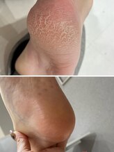 シグネイルスタジオ(CYiG nail studio)