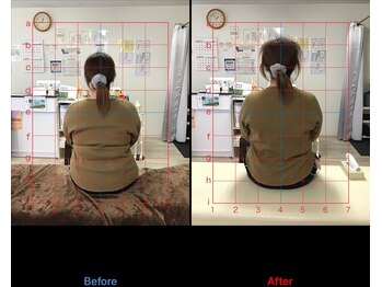 ストレチックス 近江八幡店/肩甲骨周りの痛みを撃退!