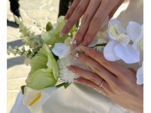 アネラネイル(Anela nail)の雰囲気（ちゅるんネイル）