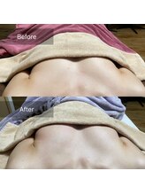 サン(SAN)/バストアップB/A